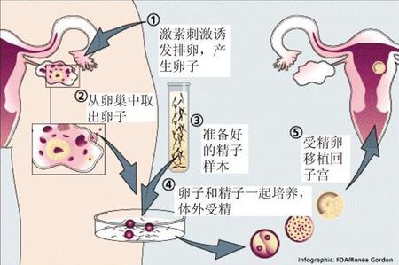 优胚鲜胚移植医学中心